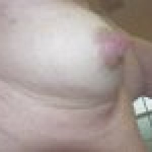 breast2.jpg