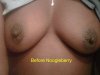breasts before noogleberry.jpg