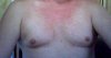 Breasts Starting out 2008.jpg