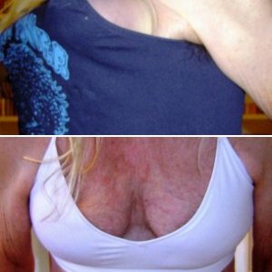 Feminization